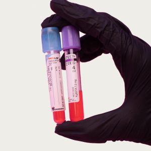 lab-test-vials